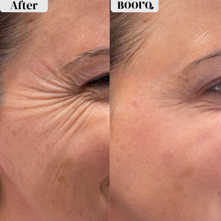 Silk Peptide Intensive Lifting Ampoule