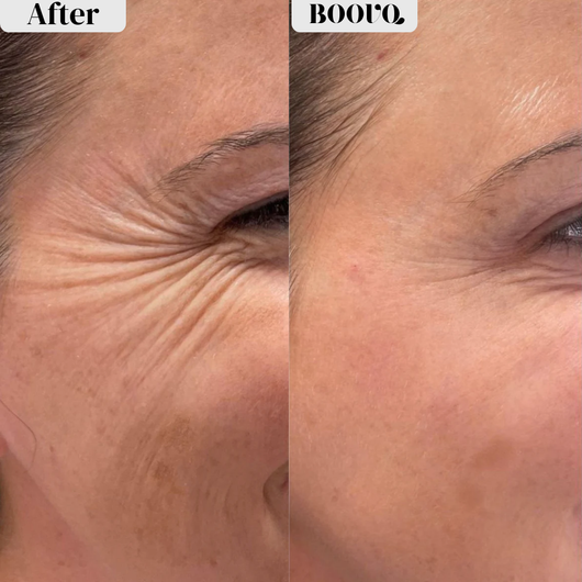 Silk Peptide Intensive Lifting Ampoule