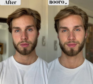 MICRO-INFUSION DART PATCHES