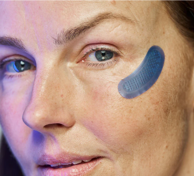 MICRO-INFUSION DART PATCHES